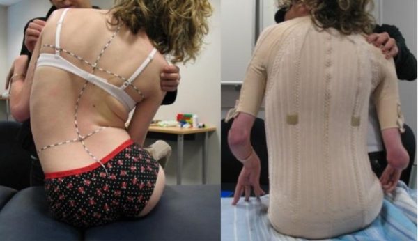 Postural Splint - Image 2